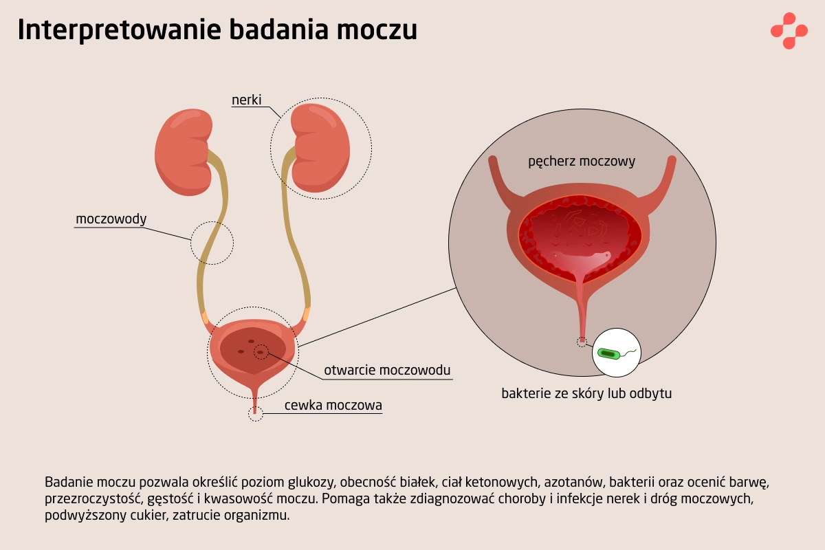 Interpretacja wyników badania moczu