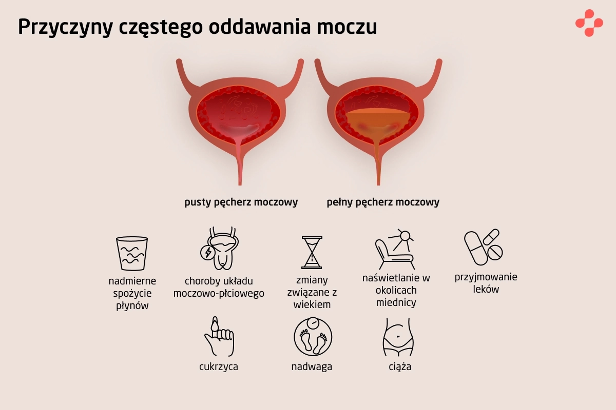 Przyczyny częstego oddawania moczu