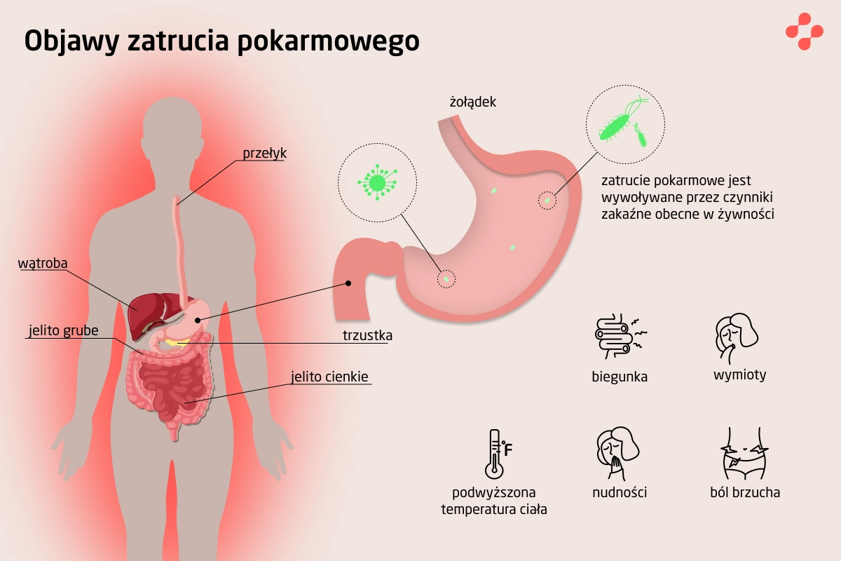 Objawy zatrucia pokarmowego