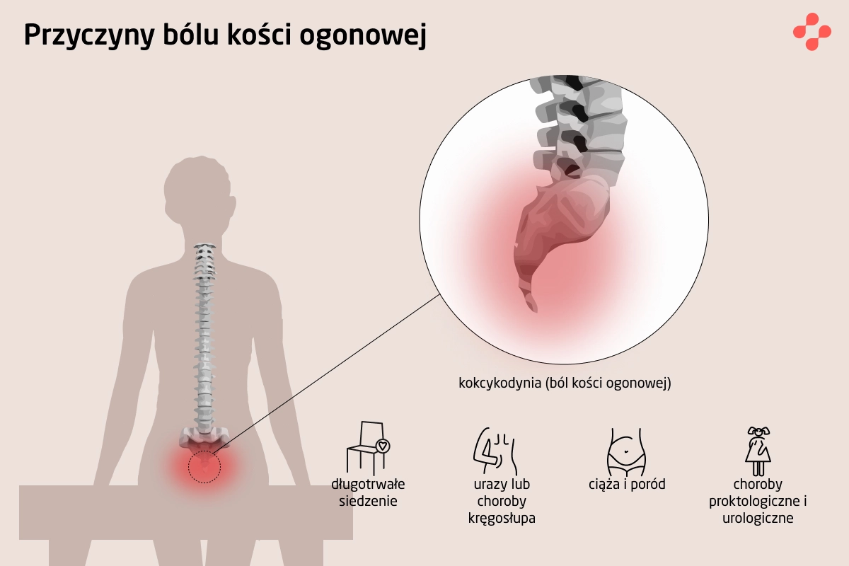 Przyczyny kokcygodynii