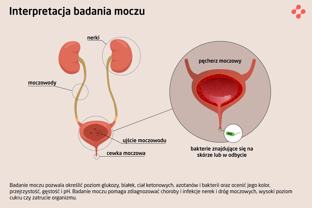Interpretacja badania moczu