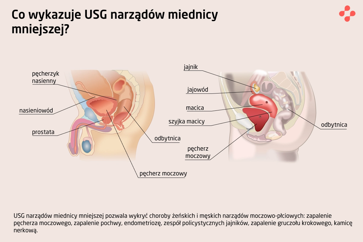 Co wykazuje USG narządów miednicy mniejszej?