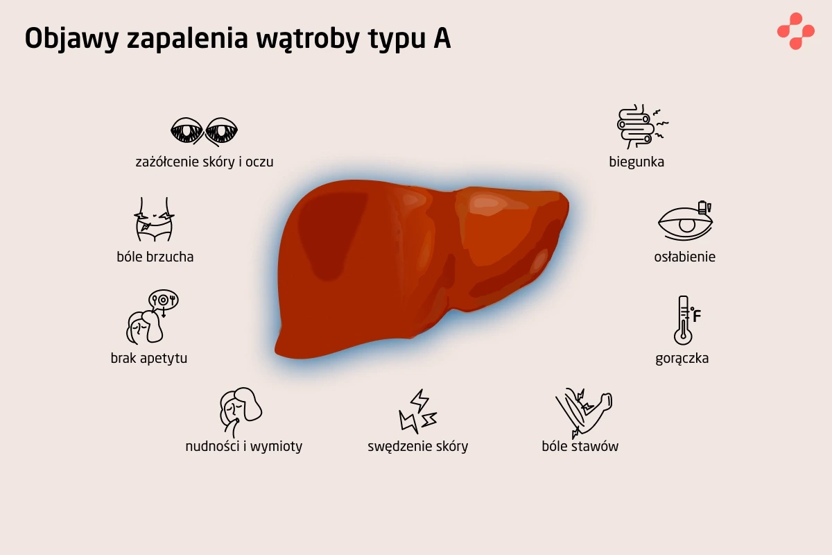 Objawy zapalenia wątroby typu A