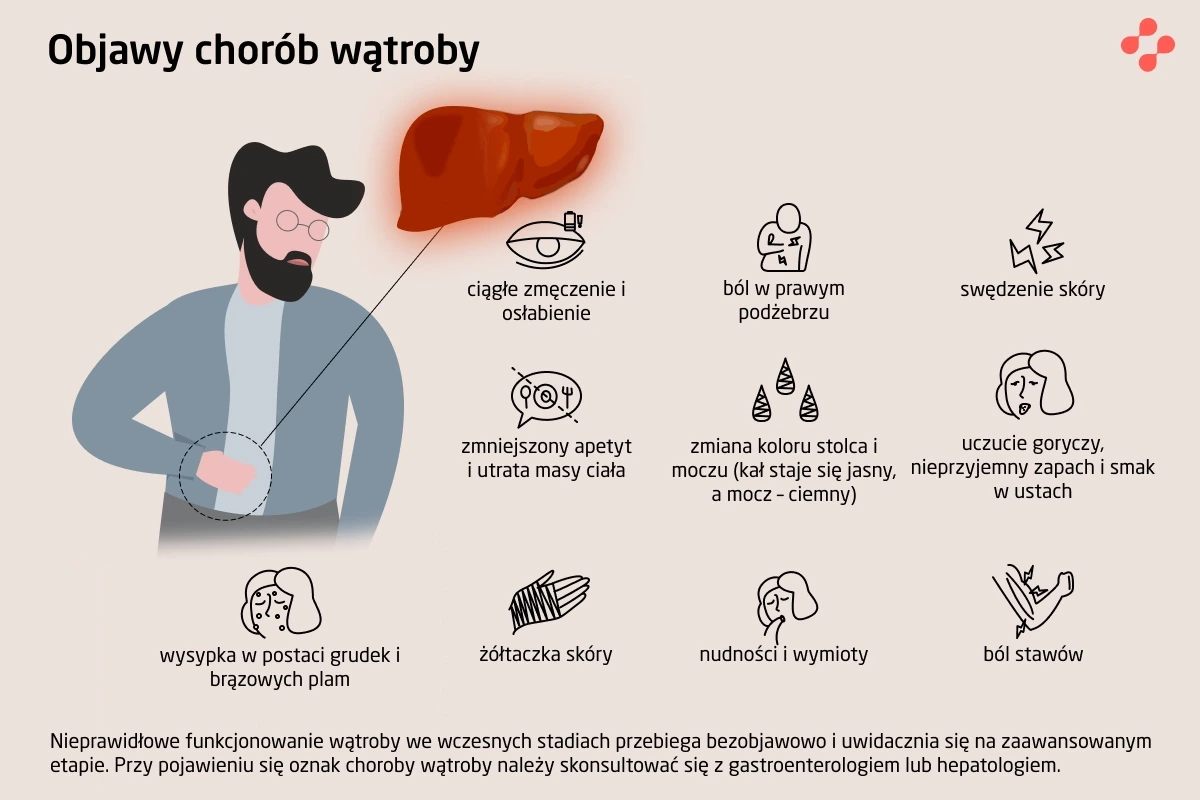 Objawy chorób wątroby