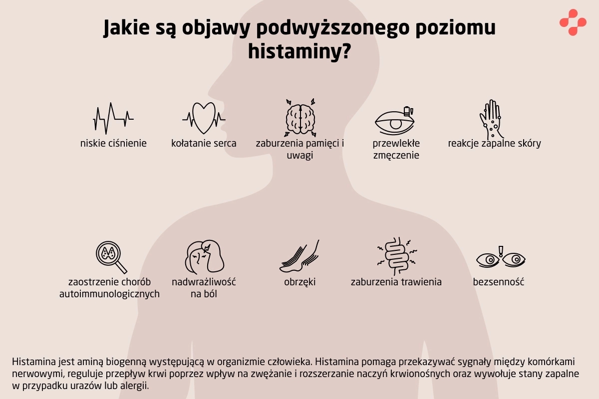 Jakie są objawy podwyższonego poziomu histaminy