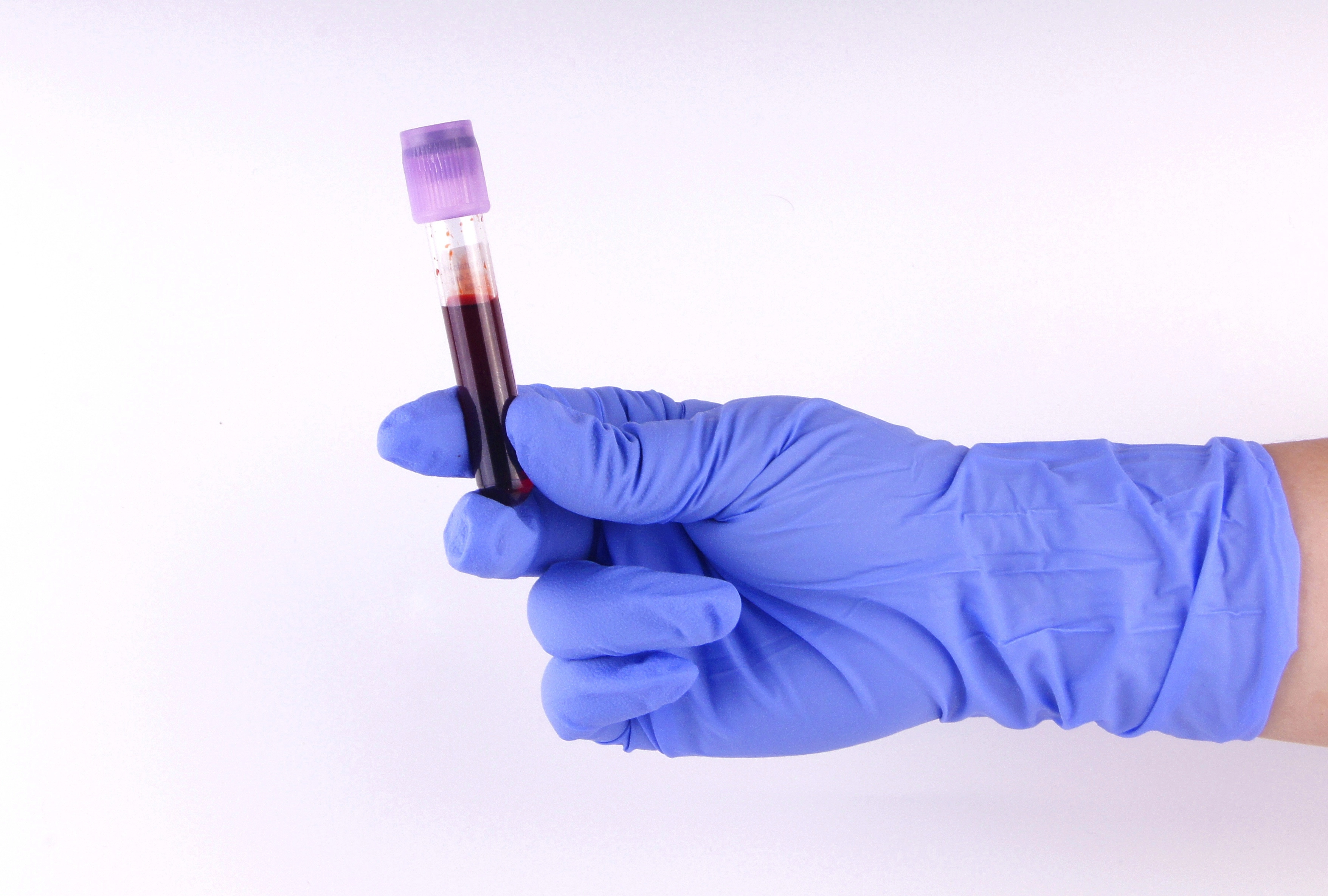Histamine: what it is and when to check its level in the body