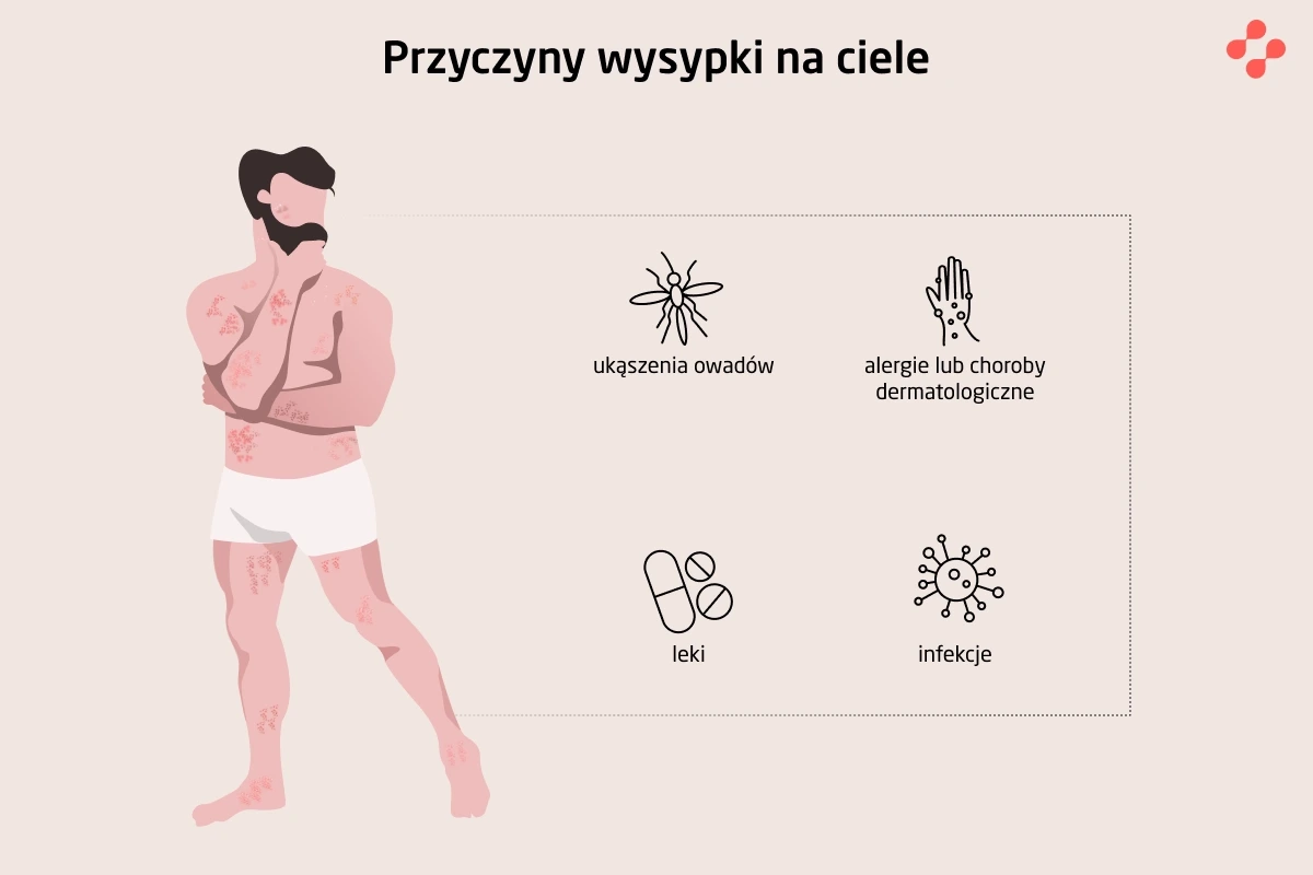 Skąd biorą się plamy na skórze