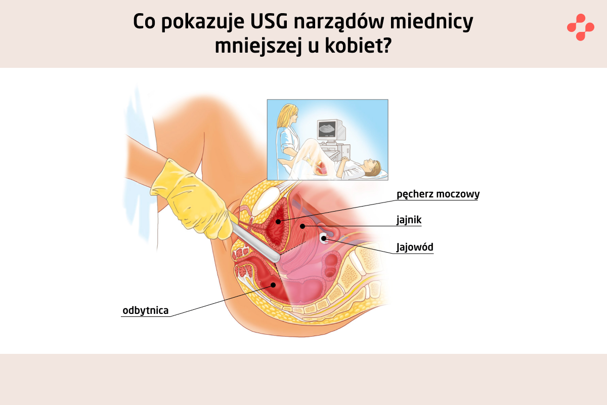 USG narządów miednicy mniejszej