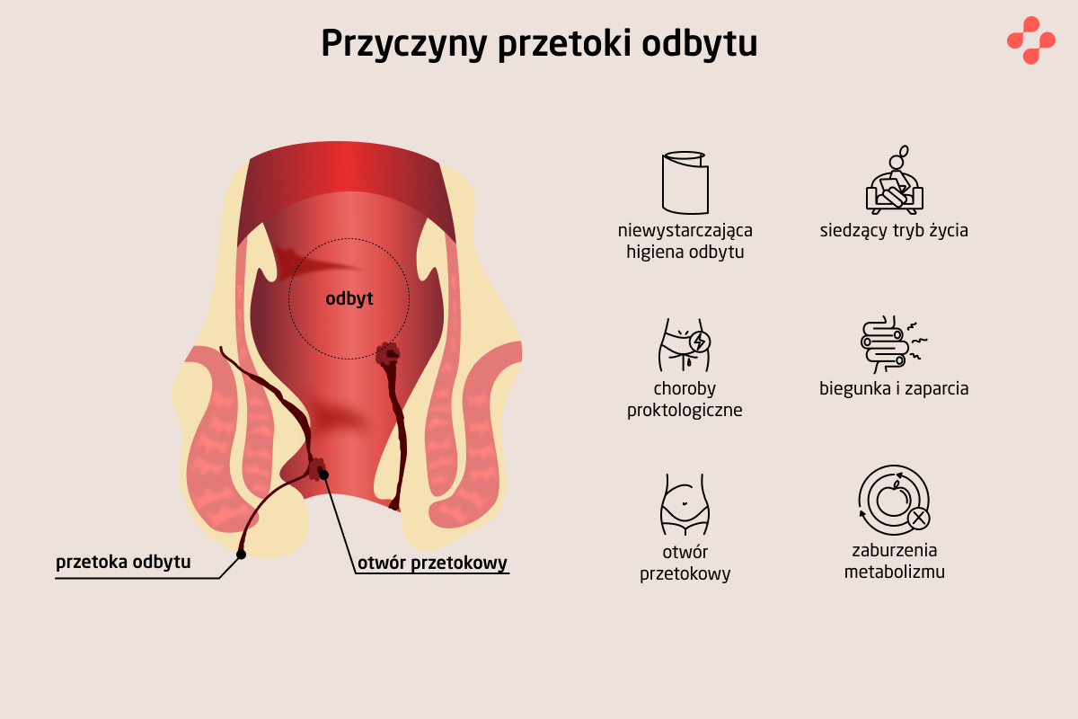 Przyczyny przetoki odbytu