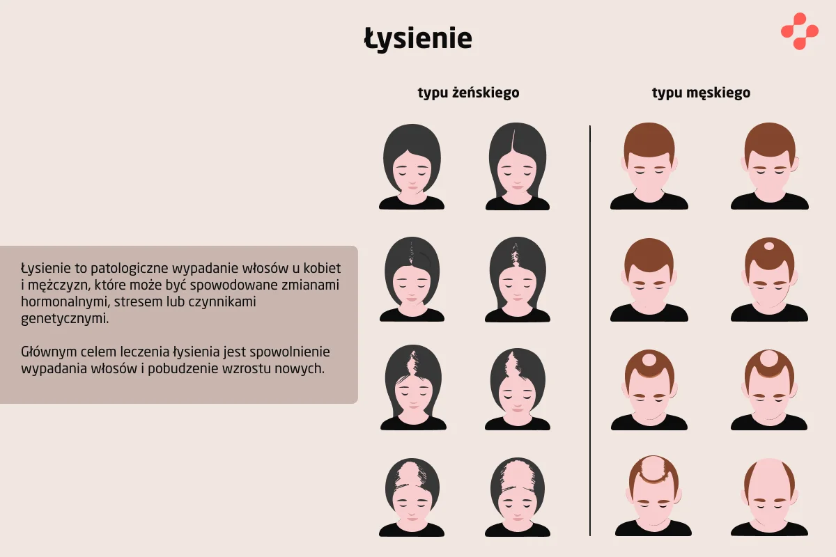 Łysienie u mężczyzn i kobiet