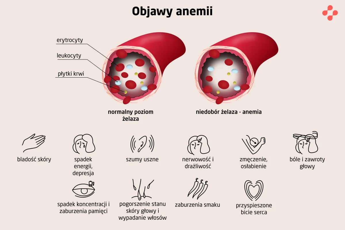 Objawy anemii