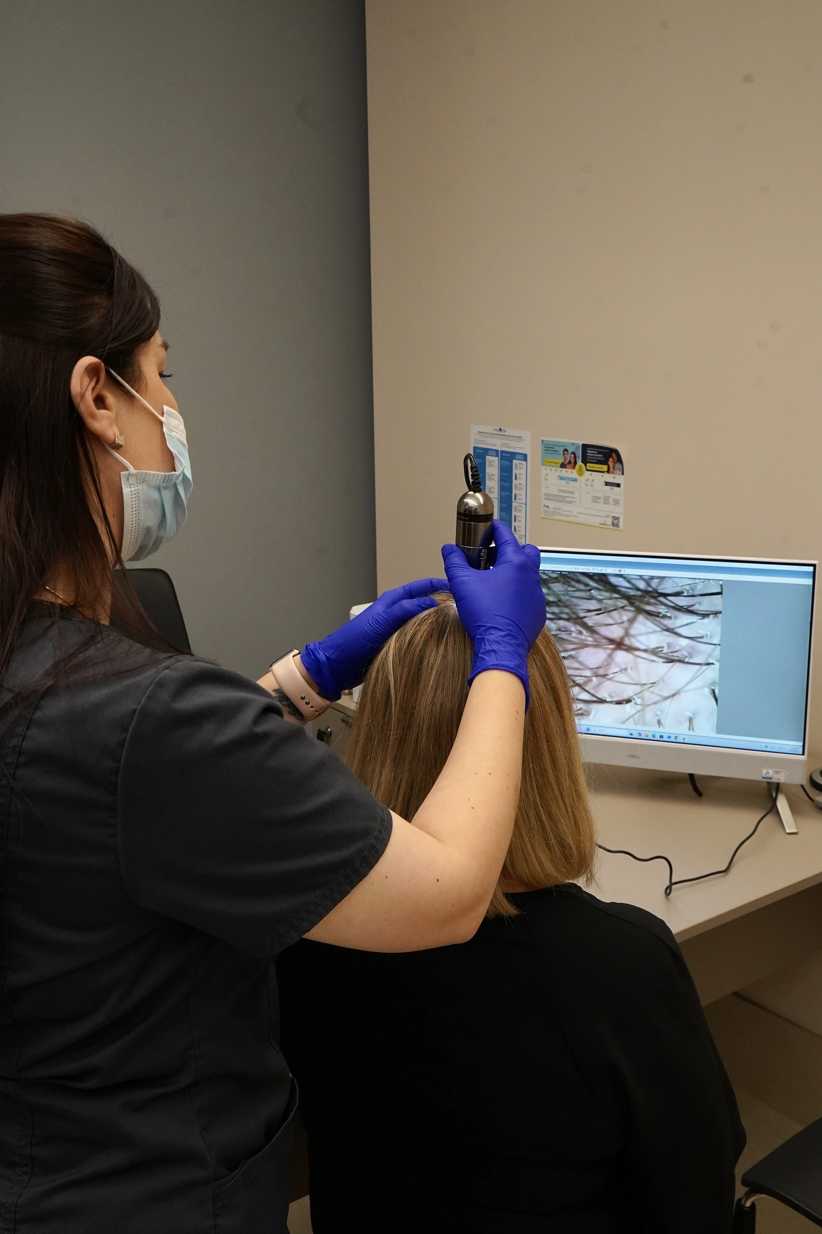 Трихоскопія в Лодзі