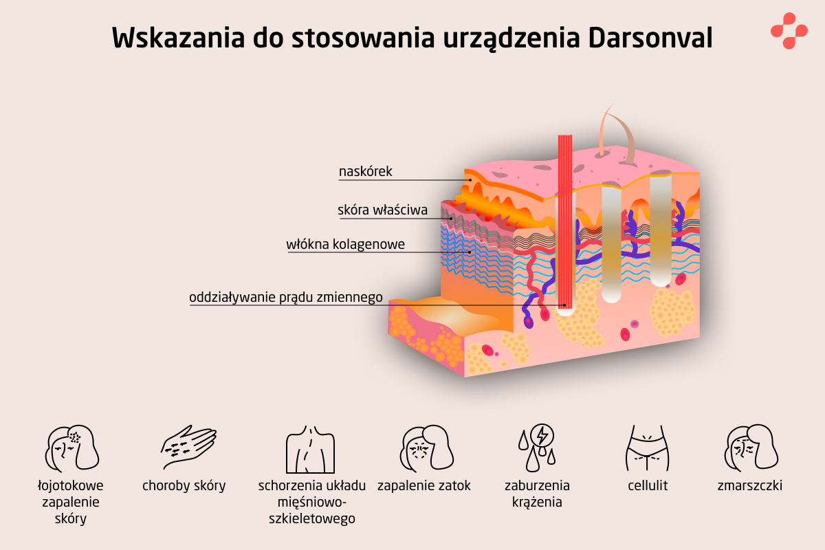 Wskazania do stosowania urządzenia Darsonval