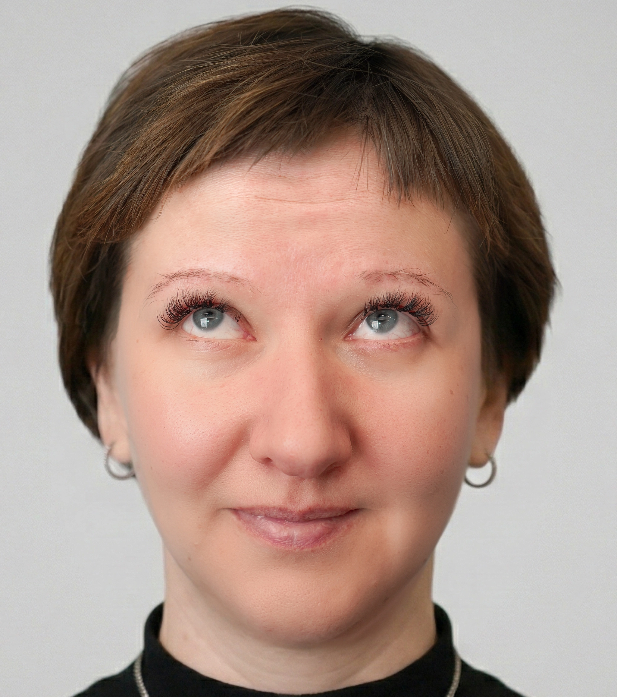 Efekty zabiegu botoksu na czoło