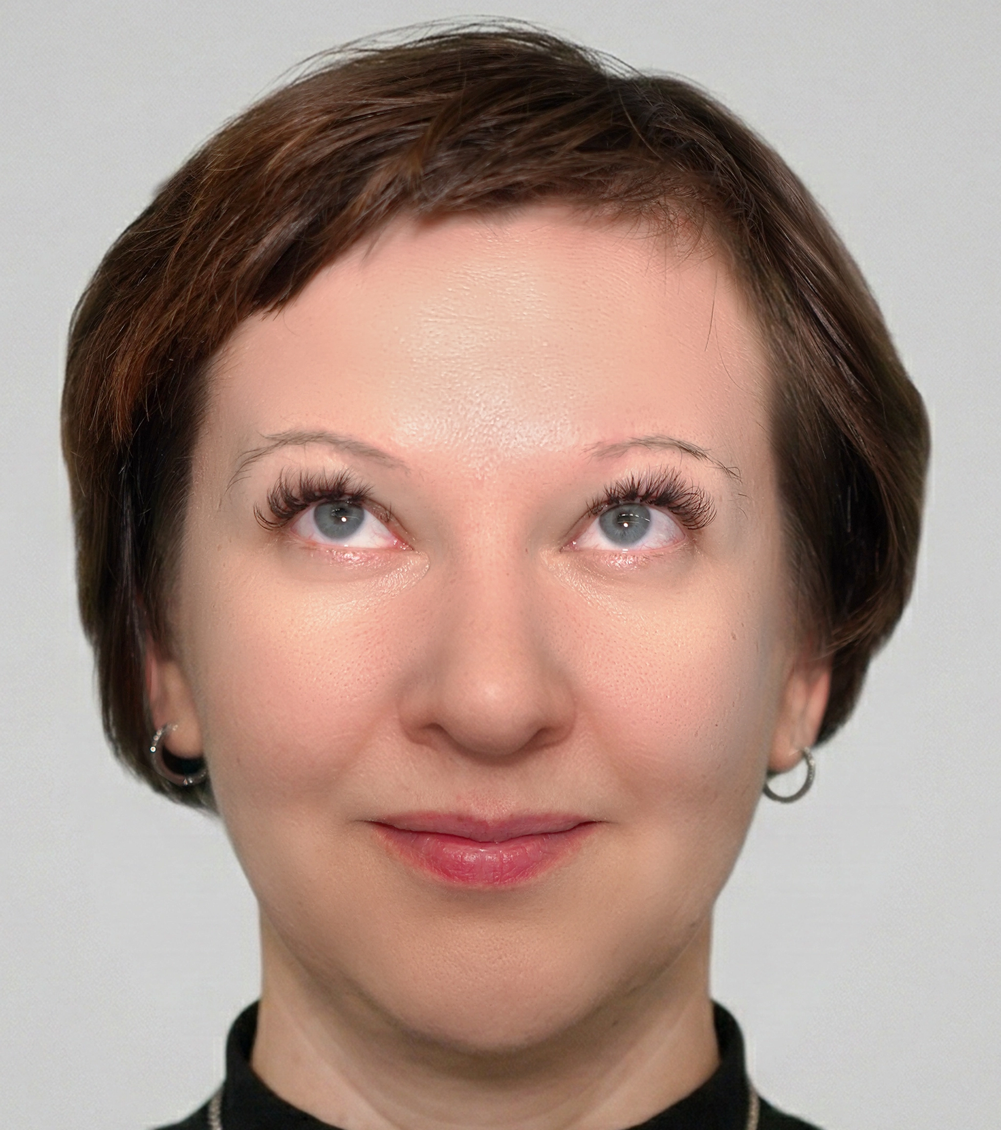 Efekty zabiegu botoksu na czoło