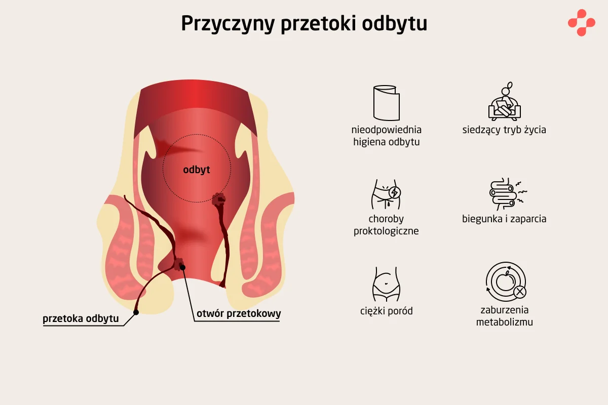 Przyczyny przetoki odbytu