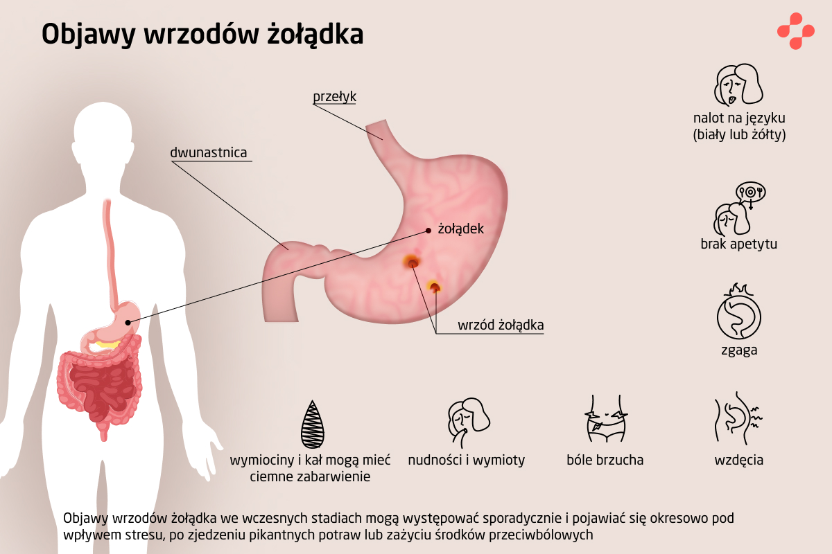 Objawy wrzodów żołądka i dwunastnicy