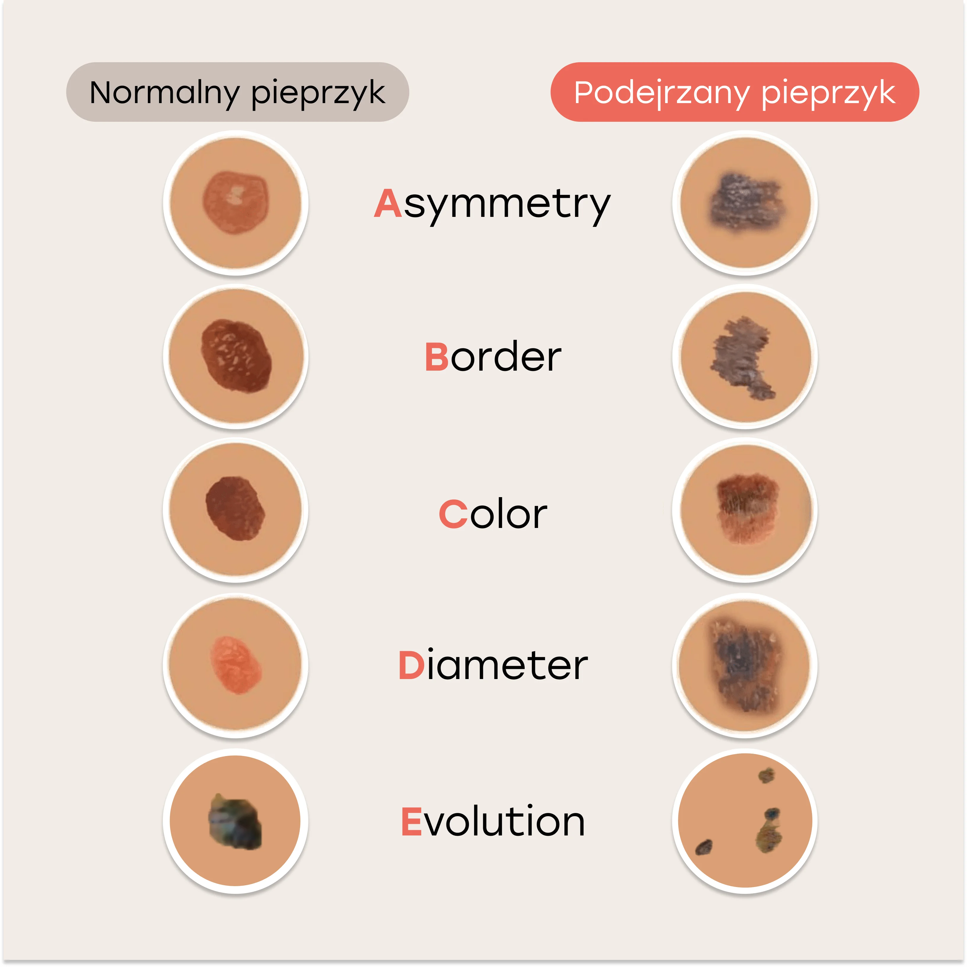 Checklista rozróżniania podejrzanych znamion