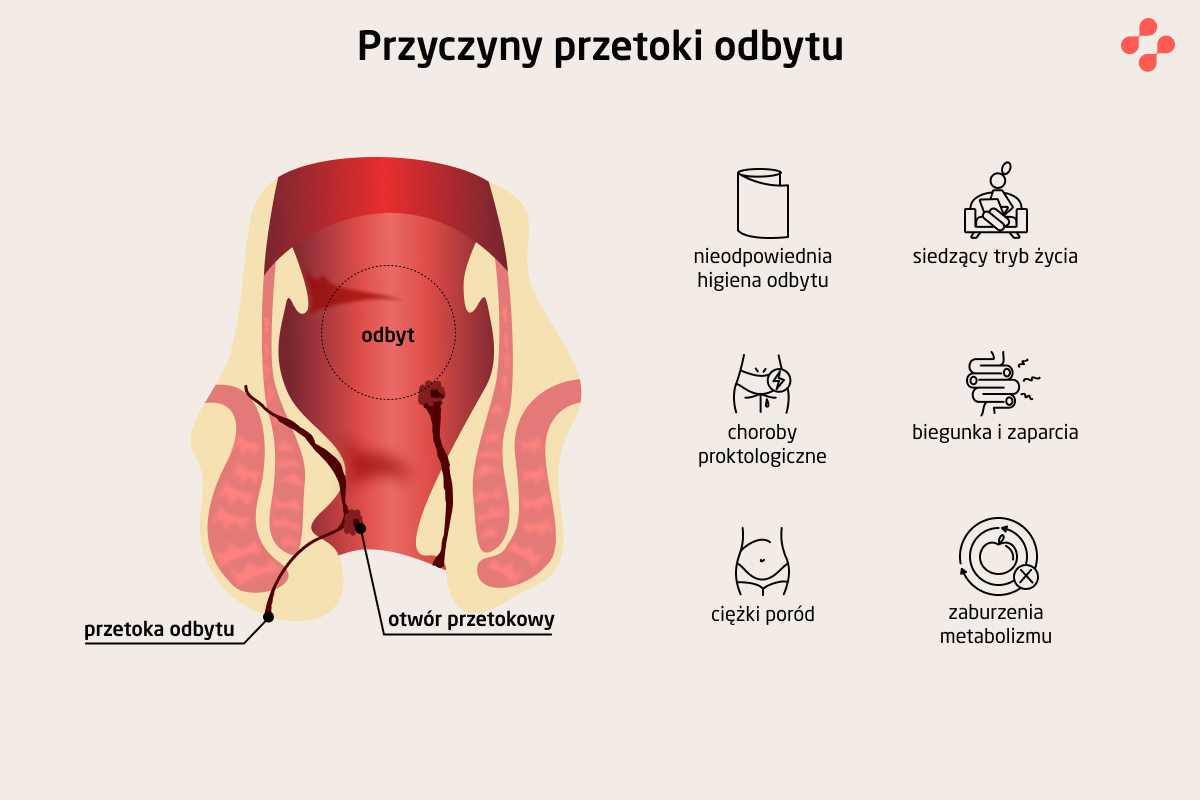 Przyczyny przetoki odbytu
