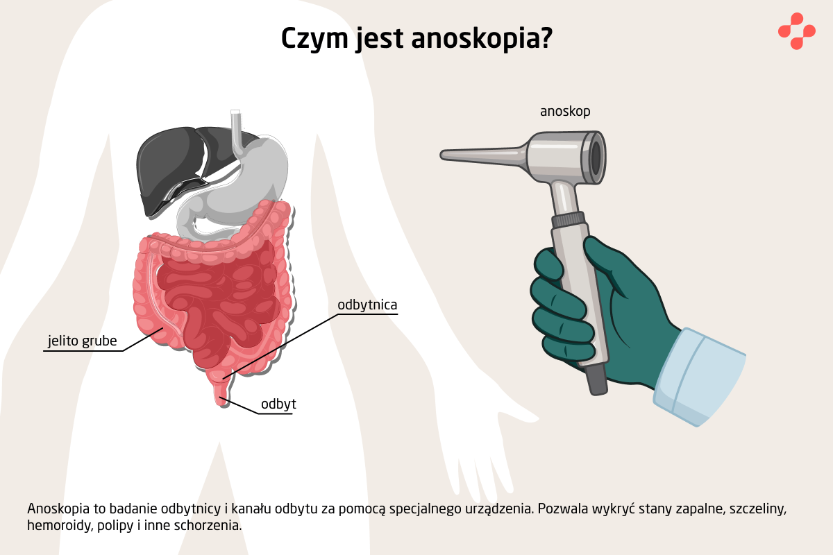 Co to jest anoskopia