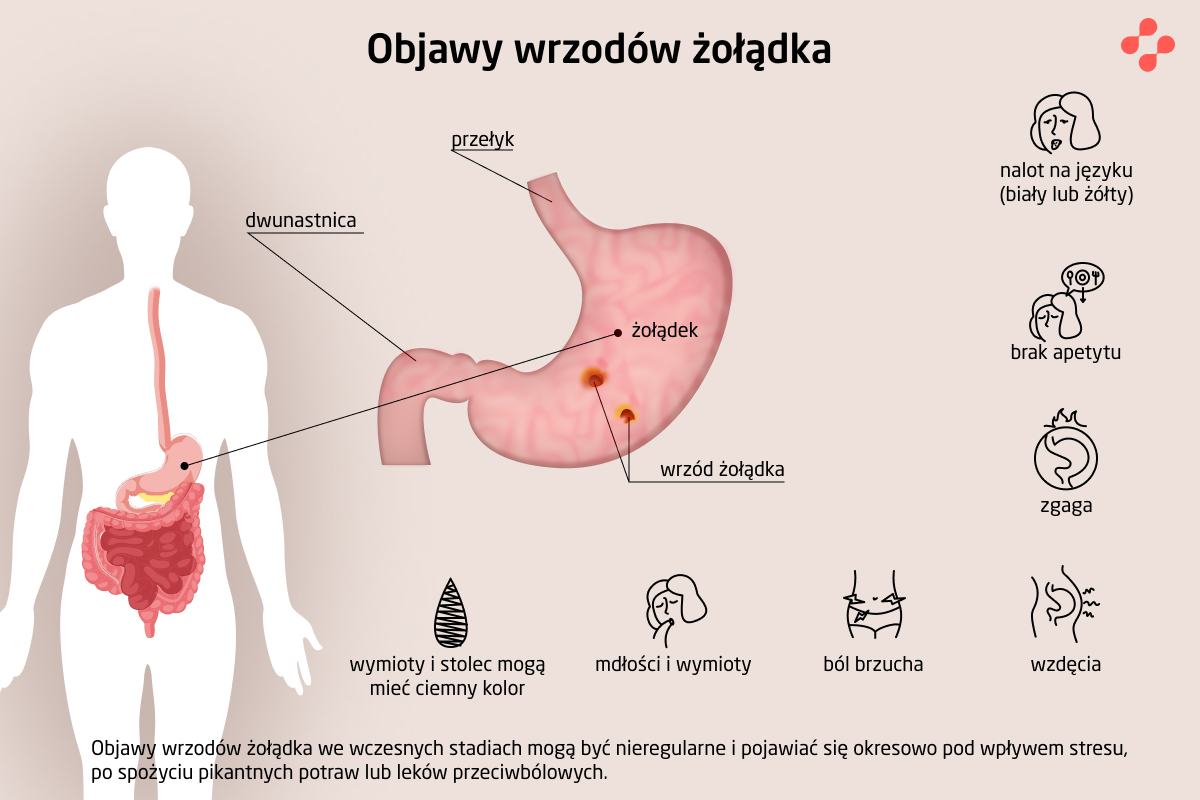 Objawy wrzodów żołądka