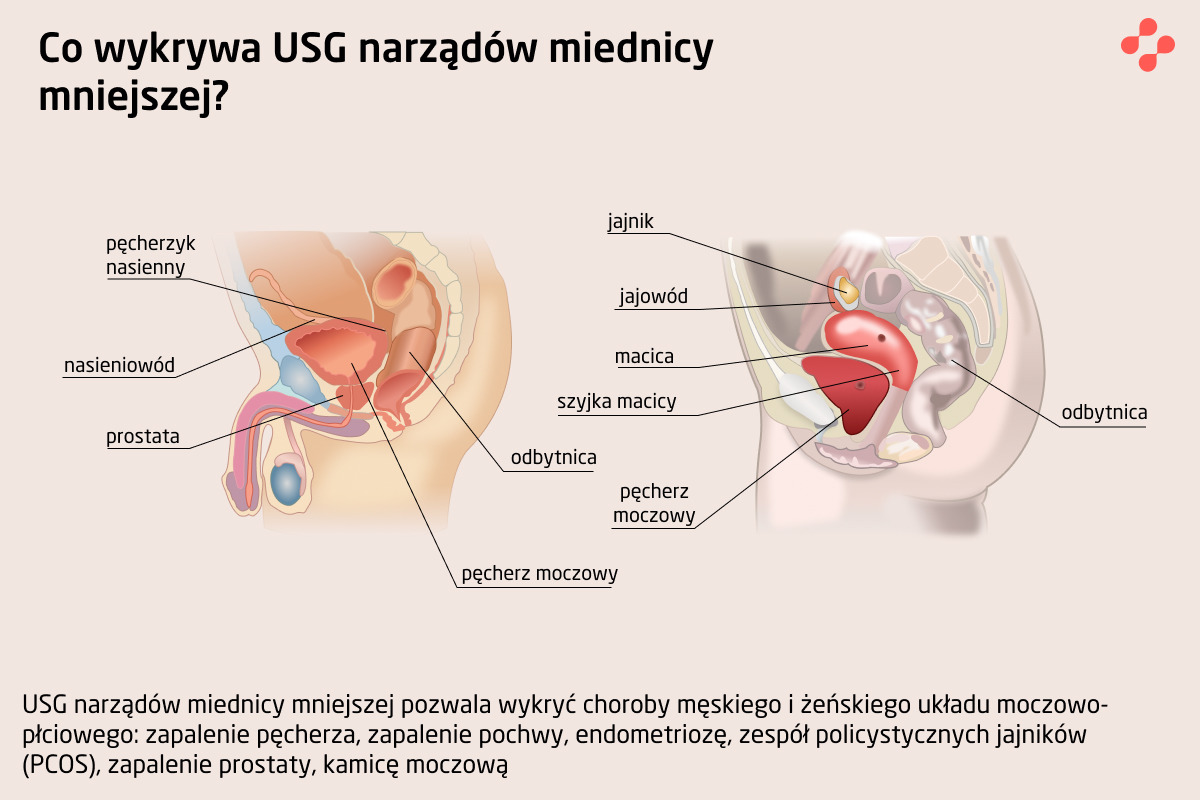 Co wykrywa USG narządów miednicy mniejszej?