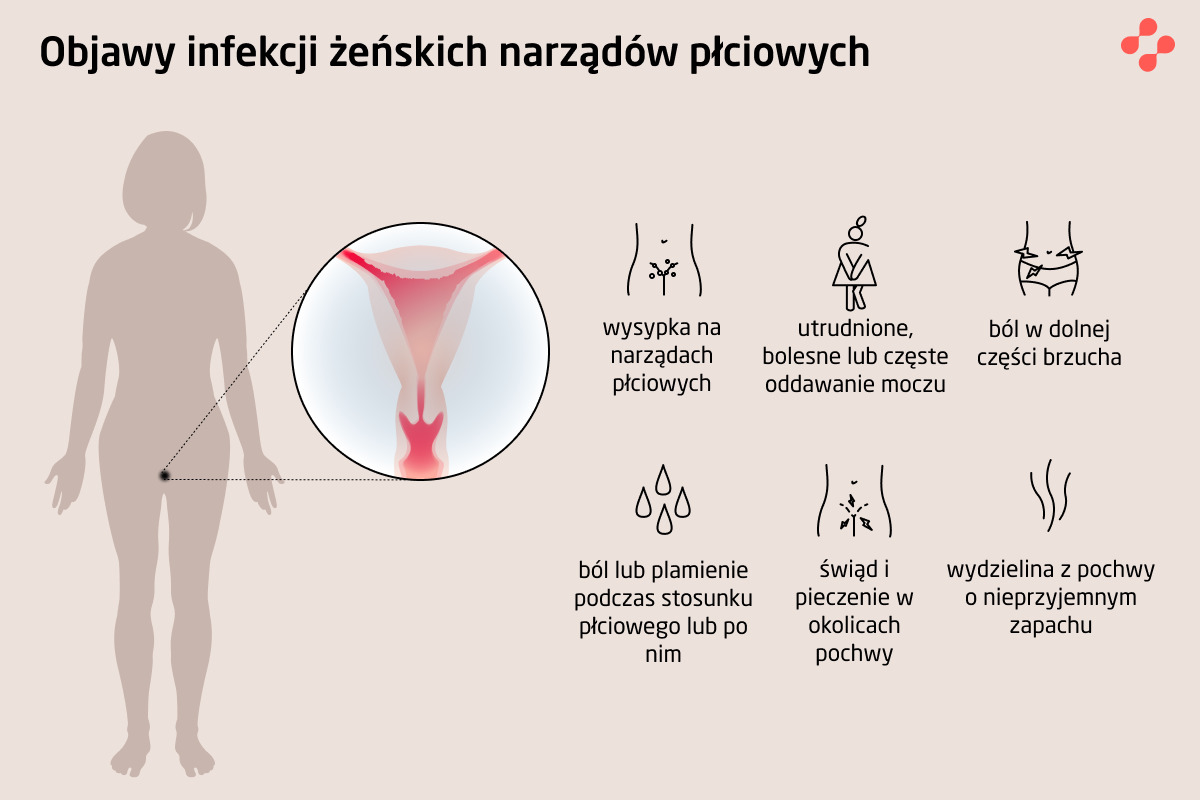 Objawy infekcji żeńskich narządów płciowych