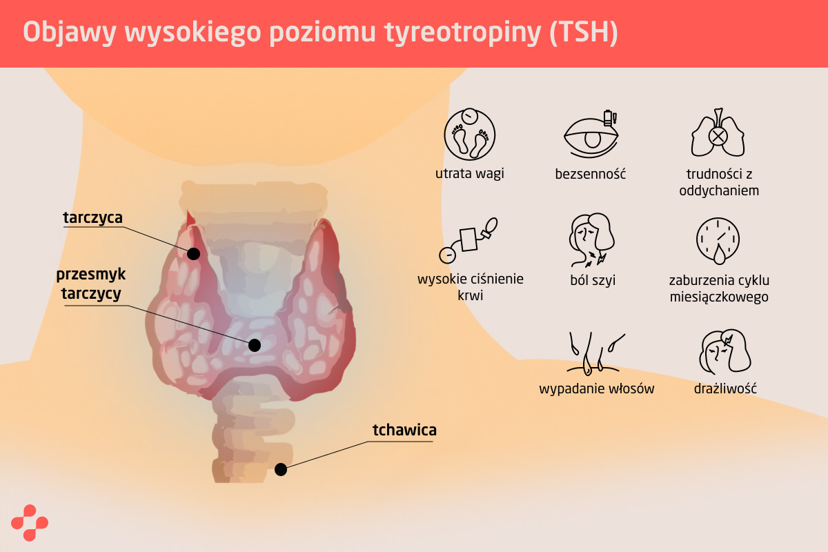 Objawy wysokiego poziomu tyreotropiny (TSH)