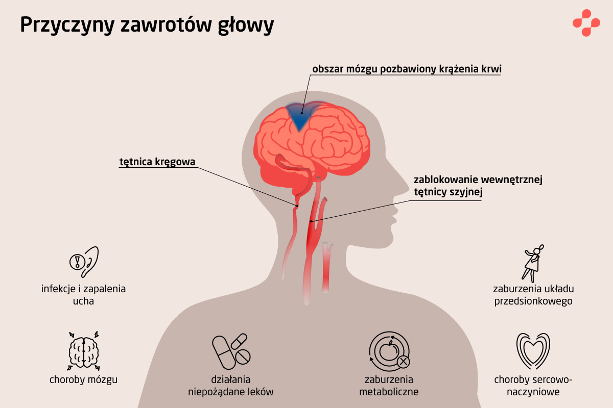 Przyczyny zawrotów głowy