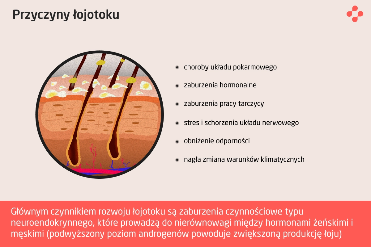 Przyczyny łojotoku