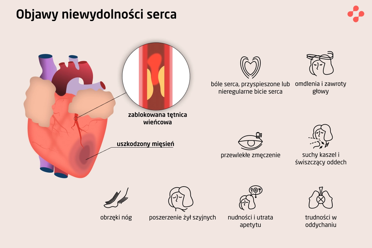 Objawy niewydolności serca