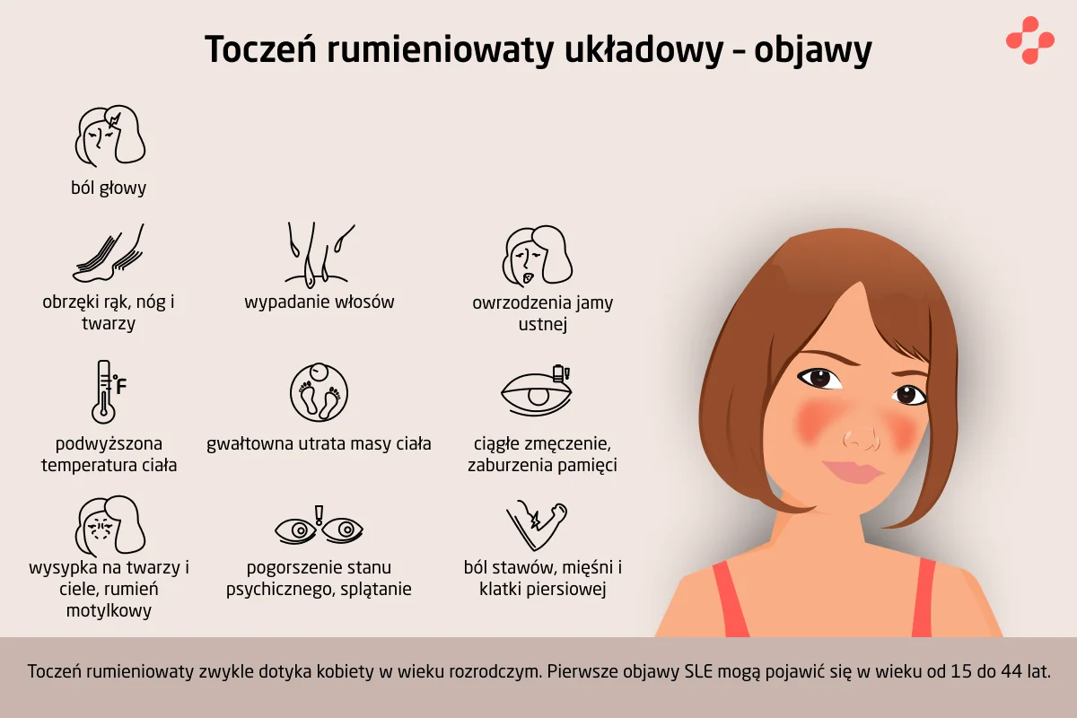 Objawy tocznia rumieniowatego układowego