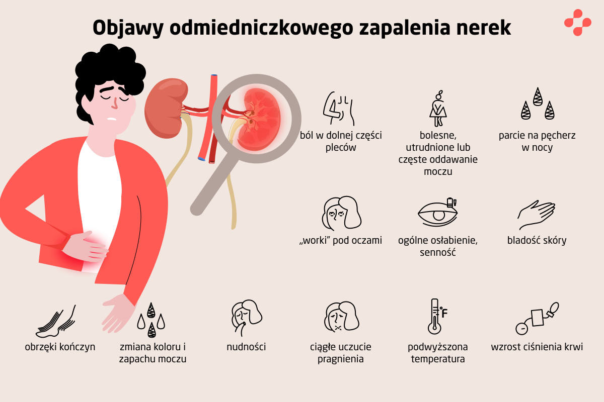 Objawy odmiedniczkowego zapalenia nerek