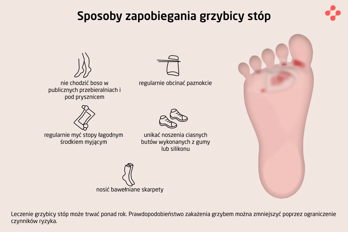 Sposoby zapobiegania grzybicy stóp